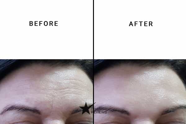 Meaningful Beauty Anti-Aging Serum Before and After